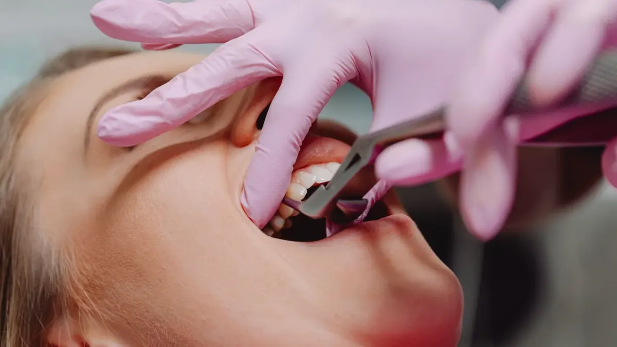 A veterinarian gently lifting a dog's lip to examine its teeth and gums