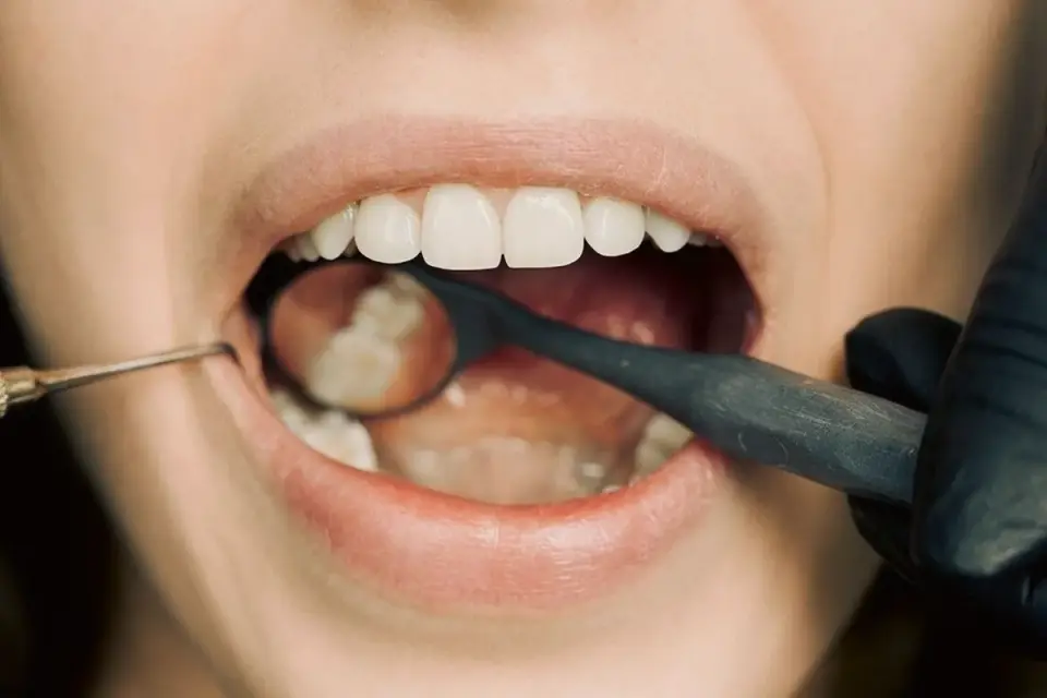 Veterinarian checking the gums and teeth of a small dog during an exam